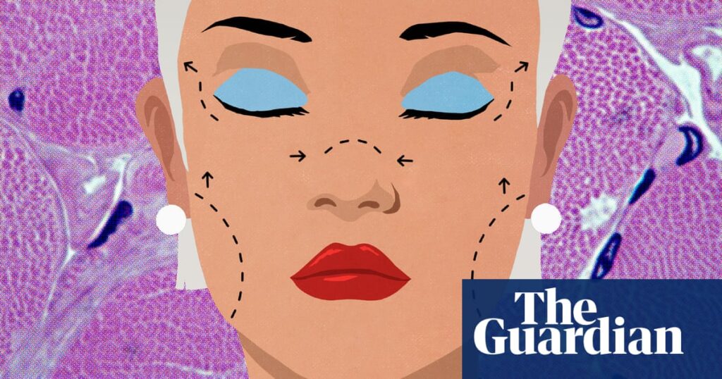 What is a deep plane facelift? Nipping into the buzzy cosmetic procedure | Well actually