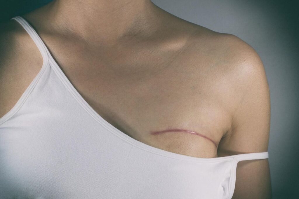 Here’s What Every Woman Should Know About Their Risk Of Breast Cancer