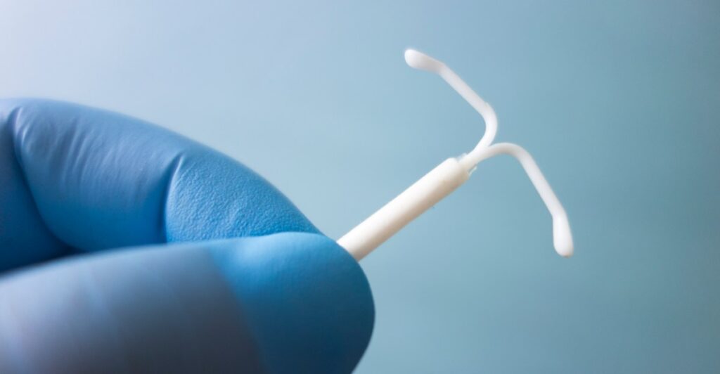 IUD birth control insertions can be painful. Doctors are finally paying attention.