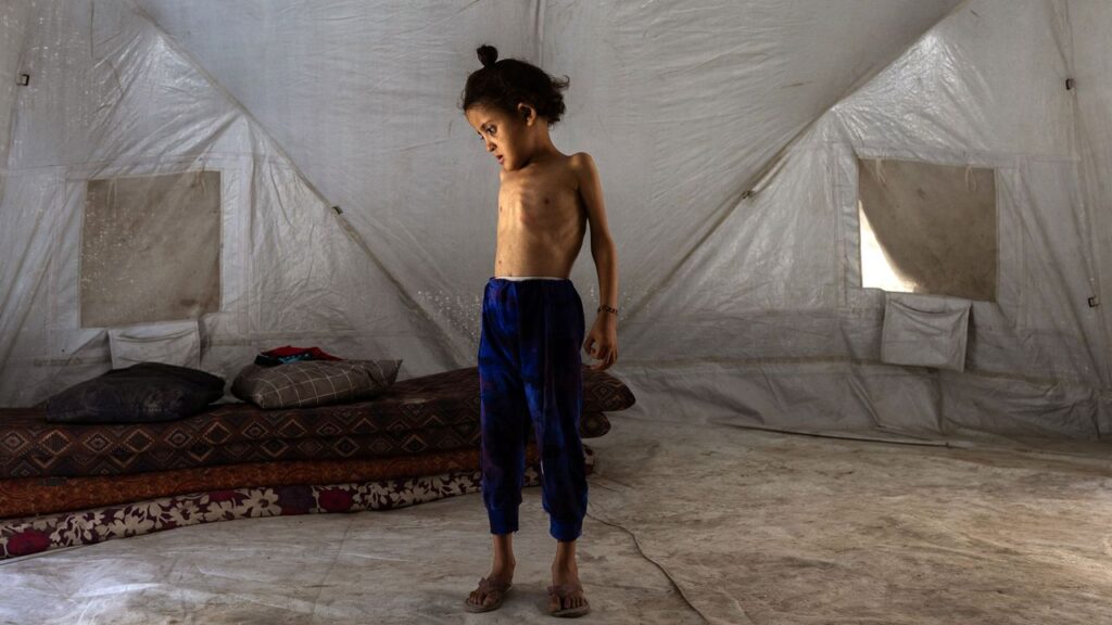 How to Prevent More Starvation Deaths in Gaza