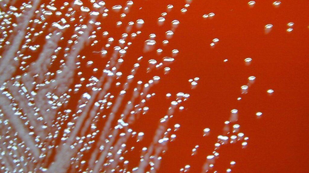 Extreme close-up photograph of white flecks growing in red blood.