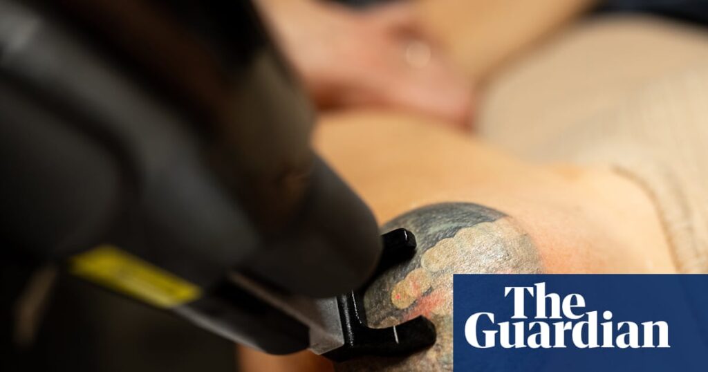 From former Nazis to refugees and DV victims, tattoo removal is giving Australians a ‘second chance’ | Tattoos From former Nazis to refugees and DV victims, tattoo removal is giving Australians a ‘second chance’ | Tattoos